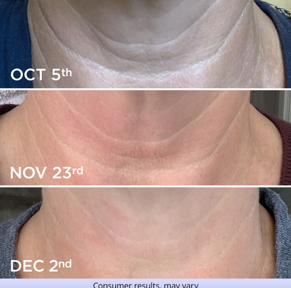 Tighten & Lift Neck Cream